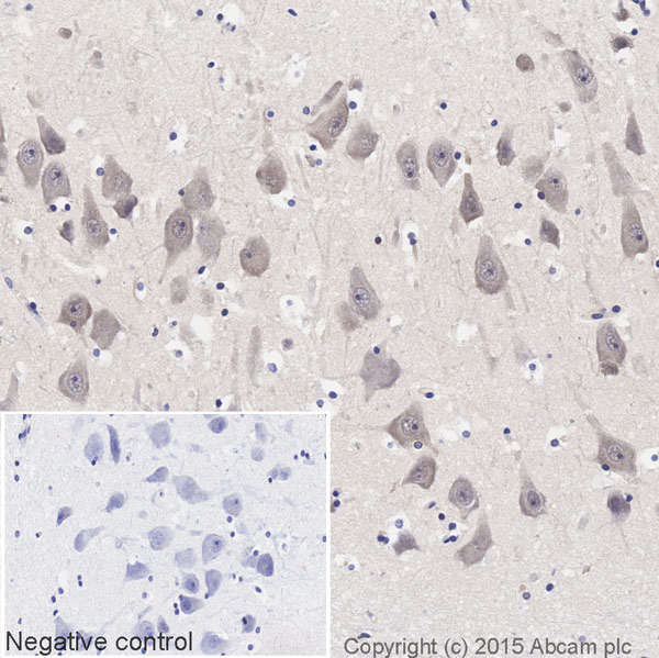 Immunohistochemistry (Formalin/PFA-fixed paraffin-embedded sections) - Biotin Anti-eIF4E antibody [Y448] (AB204637)