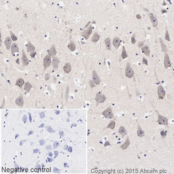 Immunohistochemistry (Formalin/PFA-fixed paraffin-embedded sections) - Biotin Anti-eIF4E antibody [Y448] (AB204637)