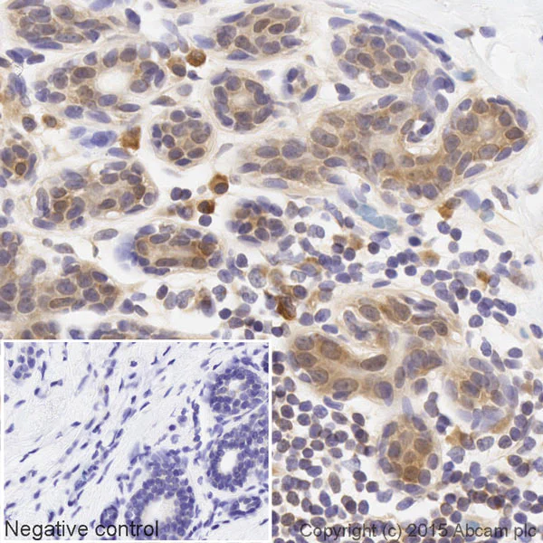Immunohistochemistry (Formalin/PFA-fixed paraffin-embedded sections) - Biotin Anti-eIF4E (phospho S209) antibody [EP2151Y] (AB201471)