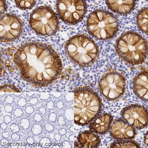 Immunohistochemistry (Formalin/PFA-fixed paraffin-embedded sections) - Biotin Anti-EpCAM antibody [EPR20532-222] (AB314939)