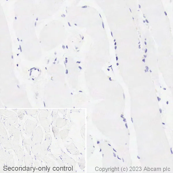 Immunohistochemistry (Formalin/PFA-fixed paraffin-embedded sections) - Biotin Anti-EpCAM antibody [EPR20532-222] (AB314939)