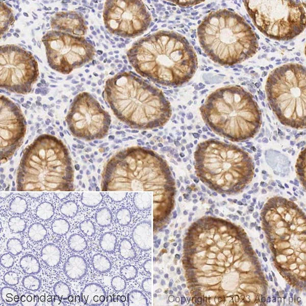 Immunohistochemistry (Formalin/PFA-fixed paraffin-embedded sections) - Biotin Anti-EpCAM antibody [EPR20532-225] (AB314940)