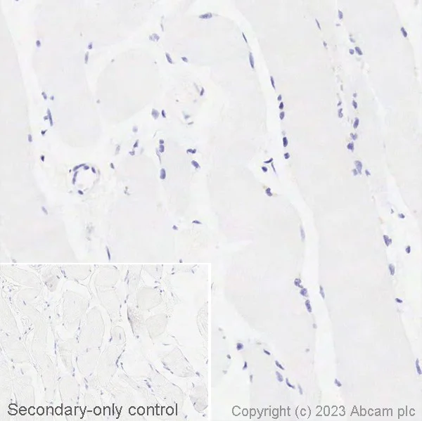 Immunohistochemistry (Formalin/PFA-fixed paraffin-embedded sections) - Biotin Anti-EpCAM antibody [EPR20532-225] (AB314940)