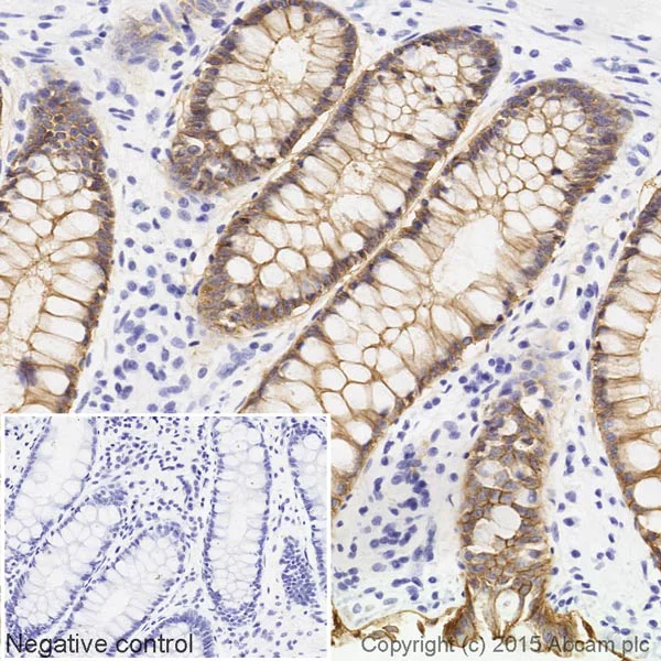 Immunohistochemistry (Formalin/PFA-fixed paraffin-embedded sections) - Biotin Anti-EpCAM antibody [EPR677(2)] (AB199758)
