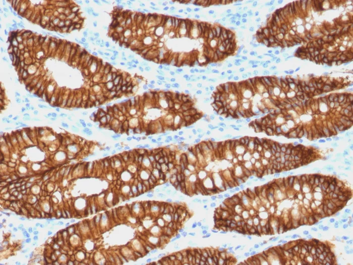 Immunohistochemistry (Formalin/PFA-fixed paraffin-embedded sections) - Biotin Anti-EpCAM antibody [VU-1D9] (AB79079)