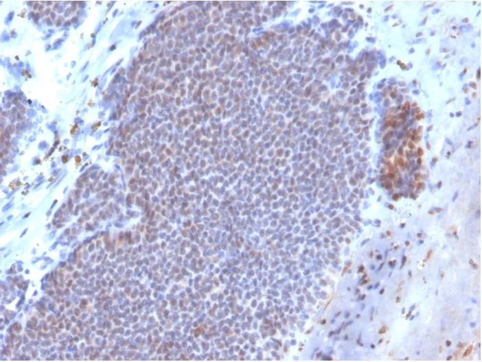 Immunohistochemistry (Formalin/PFA-fixed paraffin-embedded sections) - Biotin Anti-Estrogen Receptor antibody [ESR1/3373] (AB271815)