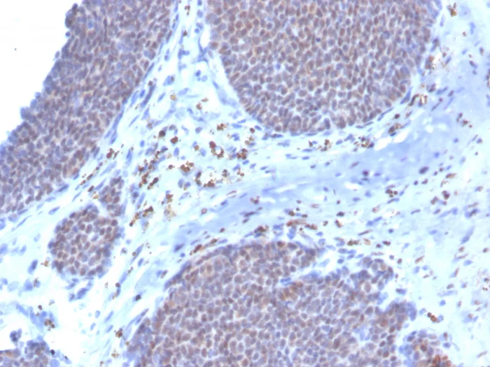 Immunohistochemistry (Formalin/PFA-fixed paraffin-embedded sections) - Biotin Anti-Estrogen Receptor antibody [ESR1/3373] (AB271815)