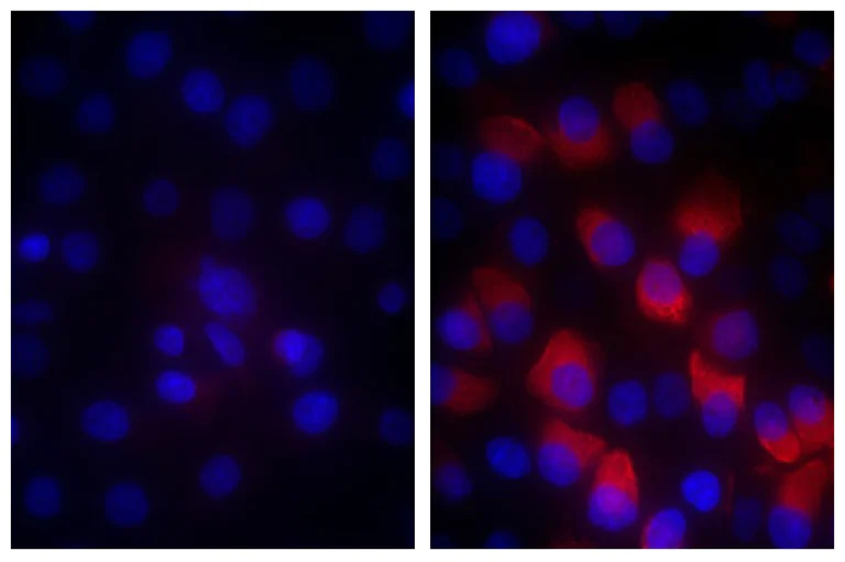 Immunocytochemistry - Biotin Anti-Fibrillin 1 antibody [11C1.3] (AB24826)