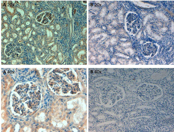 Immunohistochemistry (Formalin/PFA-fixed paraffin-embedded sections) - Biotin Anti-Fibronectin antibody (AB6584)