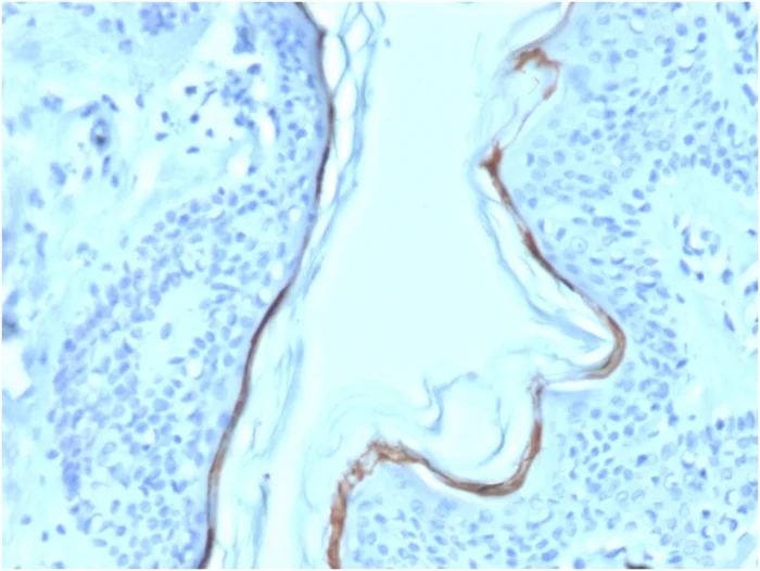 Immunohistochemistry (Formalin/PFA-fixed paraffin-embedded sections) - Biotin Anti-Filaggrin antibody [FLG/1563] (AB271816)