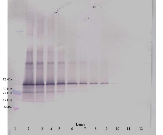 Western blot - Biotin Anti-Follistatin antibody (AB47942), expandable thumbnail