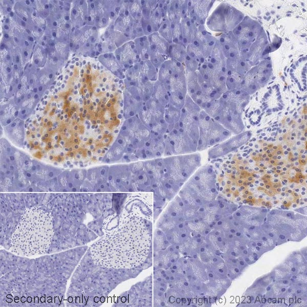 Immunohistochemistry (Formalin/PFA-fixed paraffin-embedded sections) - Biotin Anti-GAD65 + GAD67 antibody [EPR19366] (AB314398), expandable thumbnail