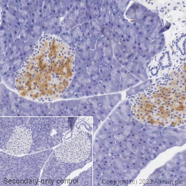 Immunohistochemistry (Formalin/PFA-fixed paraffin-embedded sections) - Biotin Anti-GAD65 + GAD67 antibody [EPR19366] (AB314398)