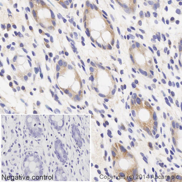 Immunohistochemistry (Formalin/PFA-fixed paraffin-embedded sections) - Biotin Anti-gamma Tubulin antibody [EPR13872] - Centrosome Marker (AB197629)