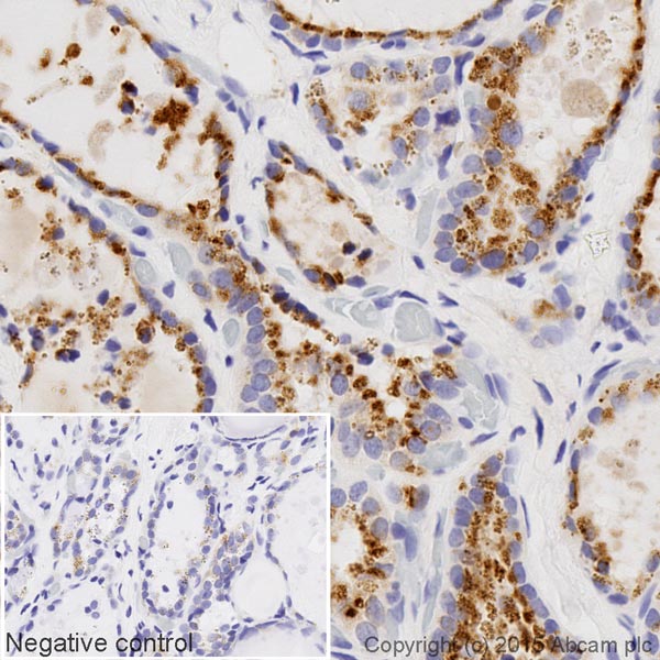Immunohistochemistry (Formalin/PFA-fixed paraffin-embedded sections) - Biotin Anti-GBA antibody [EPR5142] (AB201496), expandable thumbnail