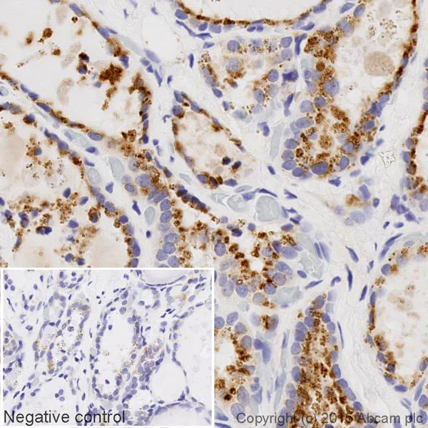 Immunohistochemistry (Formalin/PFA-fixed paraffin-embedded sections) - Biotin Anti-GBA antibody [EPR5142] (AB201496)