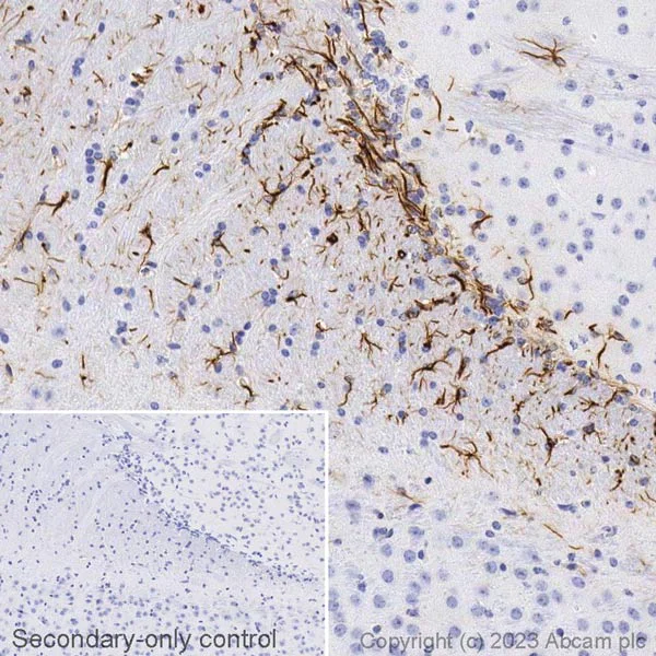Immunohistochemistry (Formalin/PFA-fixed paraffin-embedded sections) - Biotin Anti-GFAP antibody [EPR1034Y] - Astrocyte Marker (AB314264)