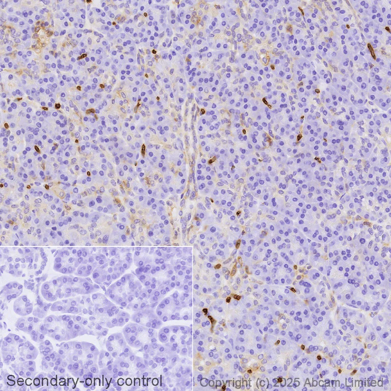 Immunohistochemistry (Formalin/PFA-fixed paraffin-embedded sections) - Biotin Anti-Glucose Transporter GLUT1 antibody [EPR3915] (AB323677)