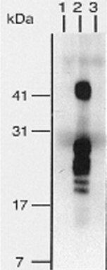 Immunoprecipitation - Biotin Anti-HBEGF/DTR antibody [4G10] (AB66793), expandable thumbnail