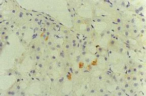 Immunohistochemistry (Frozen sections) - Biotin Anti-Hepatitis C Virus Core Antigen antibody [H6-29] (AB192050)