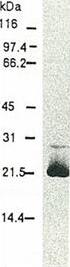 Western blot - Biotin Anti-Hepatitis C Virus Core Antigen antibody [H6-29] (AB192050), expandable thumbnail