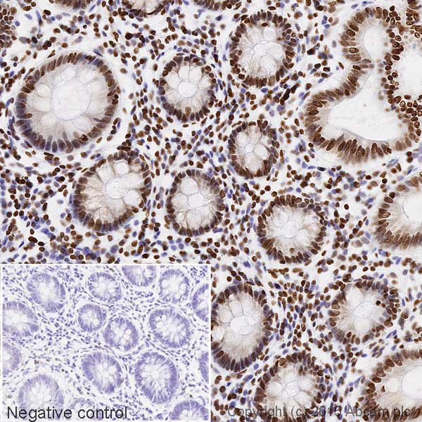 Immunohistochemistry (Formalin/PFA-fixed paraffin-embedded sections) - Biotin Anti-Histone H3 (acetyl K14) antibody [EP964Y] (AB200031), expandable thumbnail