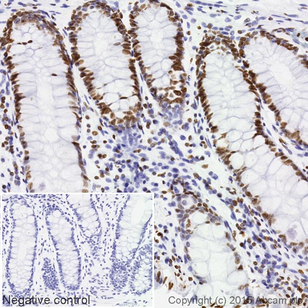 Immunohistochemistry (Formalin/PFA-fixed paraffin-embedded sections) - Biotin Anti-Histone H4 (acetyl K5) antibody [EP1000Y] (AB202886)