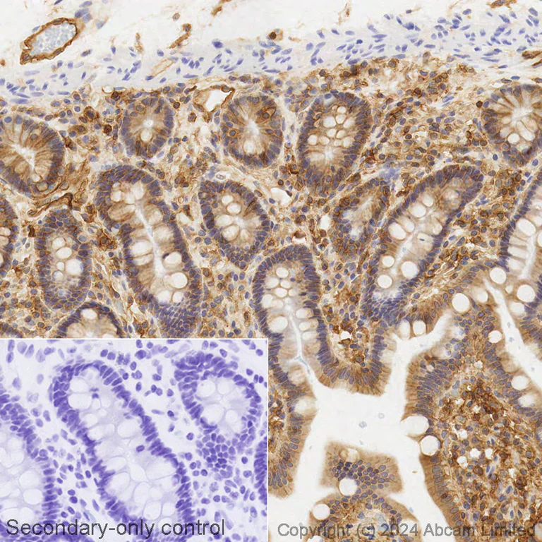 Immunohistochemistry (Formalin/PFA-fixed paraffin-embedded sections) - Biotin Anti-HLA A antibody [EP1395Y] (AB322986)