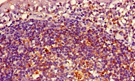 Immunohistochemistry (Formalin/PFA-fixed paraffin-embedded sections) - Biotin Anti-HLA Class II DRB1 antibody (AB193638)