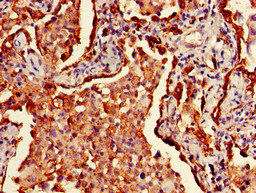 Immunohistochemistry (Formalin/PFA-fixed paraffin-embedded sections) - Biotin Anti-HLA Class II DRB1 antibody (AB193638)