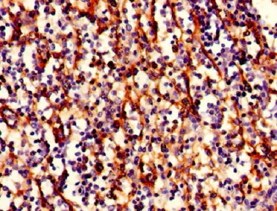 Immunohistochemistry (Formalin/PFA-fixed paraffin-embedded sections) - Biotin Anti-HLAB antibody - Extracellular domain (AB193408)