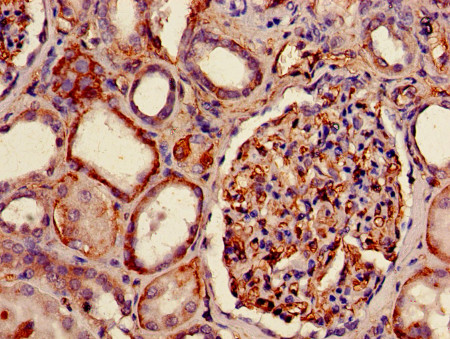 Immunohistochemistry (Formalin/PFA-fixed paraffin-embedded sections) - Biotin Anti-HLAB antibody - Extracellular domain (AB193408)