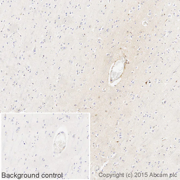 Immunohistochemistry (Formalin/PFA-fixed paraffin-embedded sections) - Biotin Anti-Human IgG antibody [EPR12700] (AB201842)