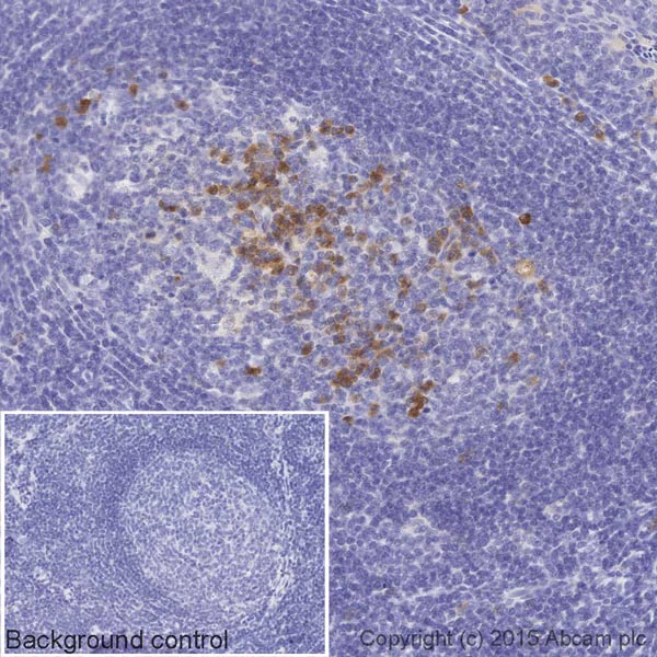 Immunohistochemistry (Formalin/PFA-fixed paraffin-embedded sections) - Biotin Anti-Human IgG antibody [EPR12700] (AB201842)