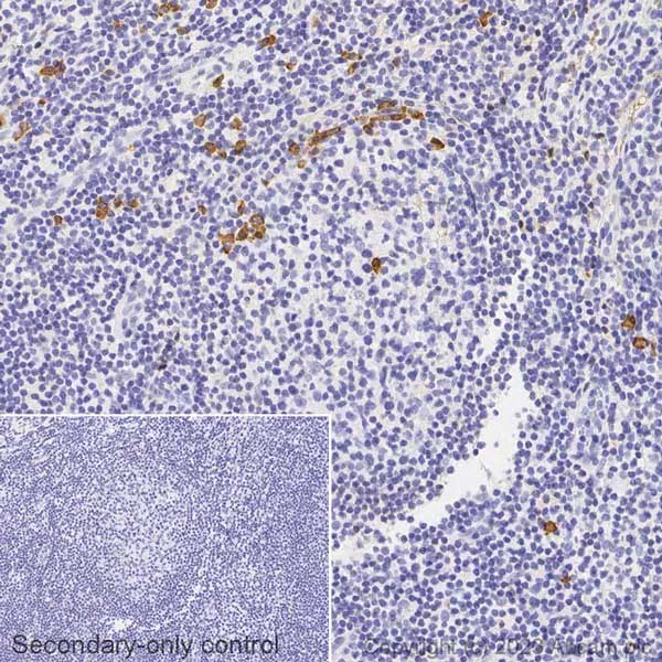 Immunohistochemistry (Formalin/PFA-fixed paraffin-embedded sections) - Biotin Anti-Human IgG antibody [EPR4421] (AB314397)
