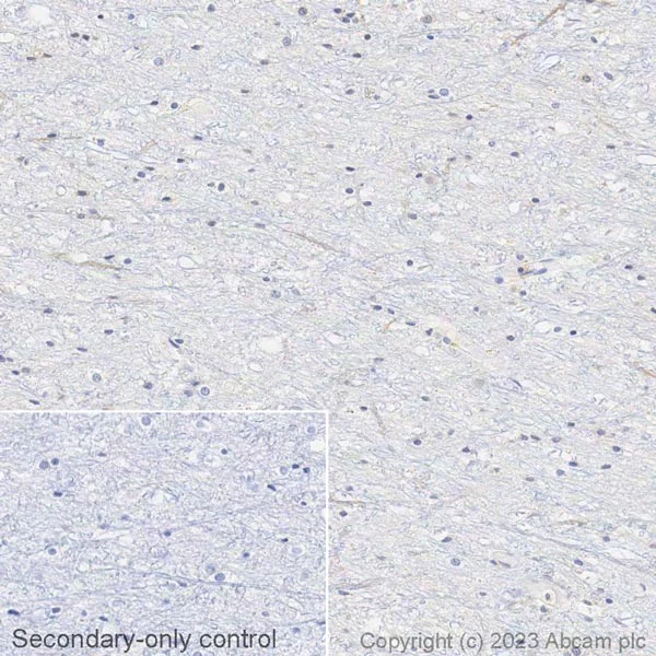 Immunohistochemistry (Formalin/PFA-fixed paraffin-embedded sections) - Biotin Anti-Human IgG antibody [EPR4421] (AB314397)