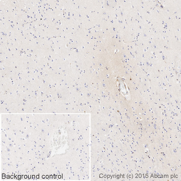 Immunohistochemistry (Formalin/PFA-fixed paraffin-embedded sections) - Biotin Anti-Human IgG3 antibody [EPR4419] (AB201248)
