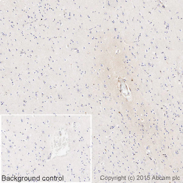 Immunohistochemistry (Formalin/PFA-fixed paraffin-embedded sections) - Biotin Anti-Human IgG3 antibody [EPR4419] (AB201248)