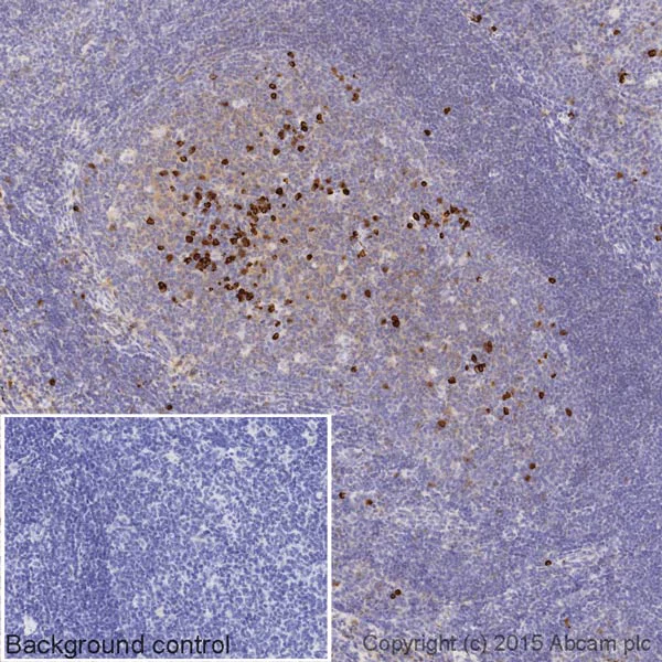Immunohistochemistry (Formalin/PFA-fixed paraffin-embedded sections) - Biotin Anti-Human IgG3 antibody [EPR4419] (AB201248)