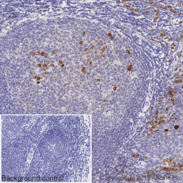 Immunohistochemistry (Formalin/PFA-fixed paraffin-embedded sections) - Biotin Anti-Human Kappa Chain antibody [EPR5539-71-8] (AB201490)
