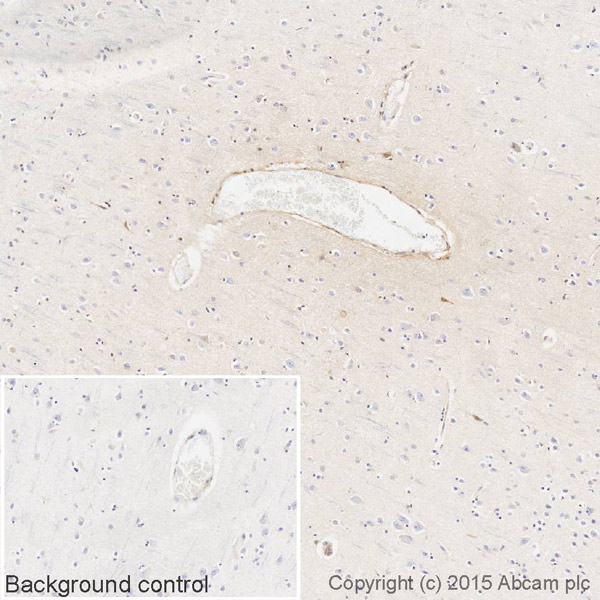 Immunohistochemistry (Formalin/PFA-fixed paraffin-embedded sections) - Biotin Anti-Human Kappa Chain antibody [EPR5539-71-8] (AB201490), expandable thumbnail