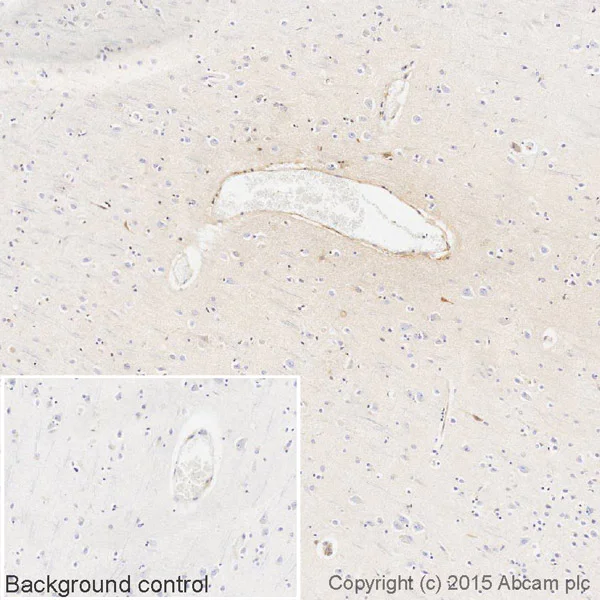 Immunohistochemistry (Formalin/PFA-fixed paraffin-embedded sections) - Biotin Anti-Human Kappa Chain antibody [EPR5539-71-8] (AB201490)