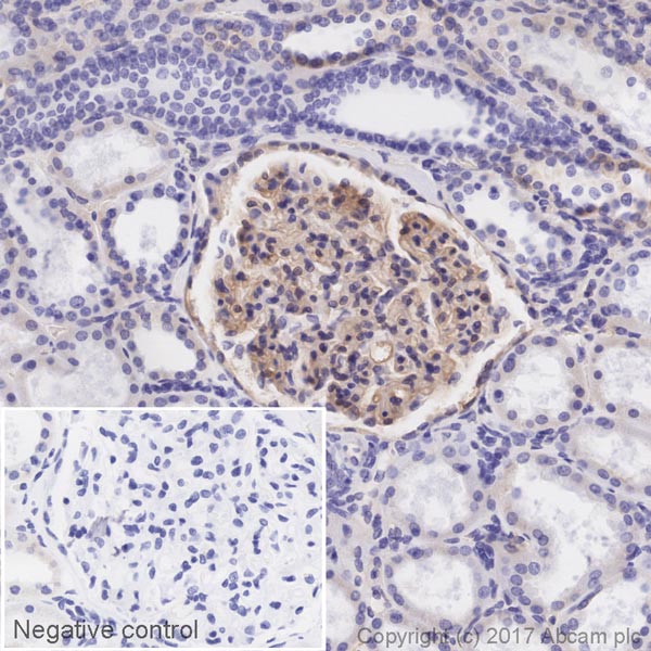 Immunohistochemistry (Formalin/PFA-fixed paraffin-embedded sections) - Biotin Anti-ICAM1 antibody [EPR4776] (AB217075)