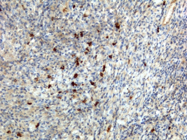 Immunohistochemistry (Formalin/PFA-fixed paraffin-embedded sections) - Biotin Anti-IgA antibody [RM128] (AB224184), expandable thumbnail