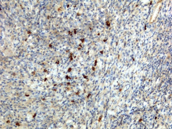 Immunohistochemistry (Formalin/PFA-fixed paraffin-embedded sections) - Biotin Anti-IgA antibody [RM128] (AB224184)