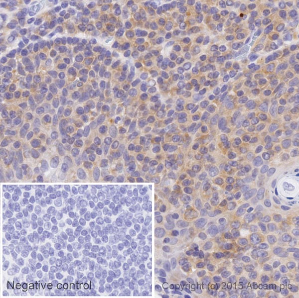 Immunohistochemistry (Formalin/PFA-fixed paraffin-embedded sections) - Biotin Anti-IL-11RA antibody [EPR5446] (AB202924), expandable thumbnail