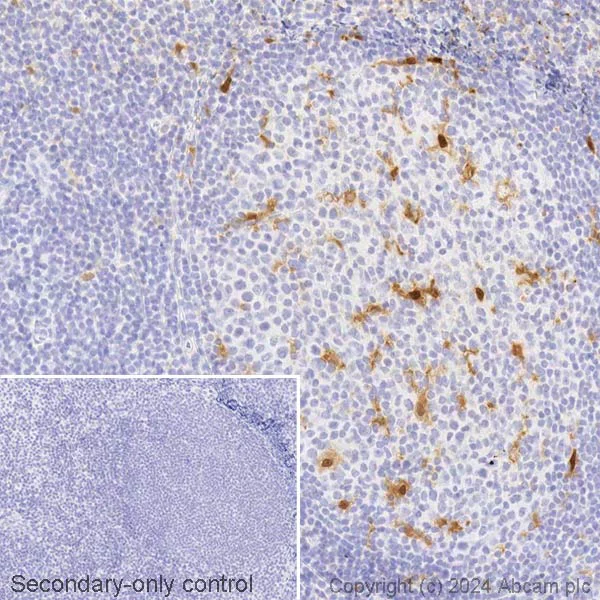Immunohistochemistry (Formalin/PFA-fixed paraffin-embedded sections) - Biotin Anti-IL-18 antibody [EPR19954-188] (AB316302)