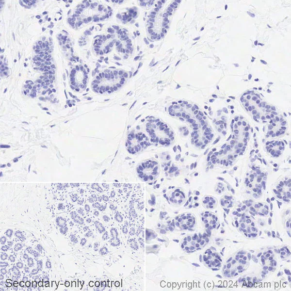 Immunohistochemistry (Formalin/PFA-fixed paraffin-embedded sections) - Biotin Anti-IL-18 antibody [EPR19954-188] (AB316302)