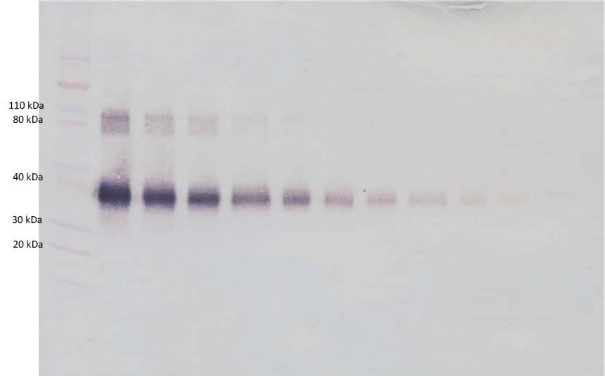 Western blot - Biotin Anti-IL-2 Receptor alpha antibody (AB271230), expandable thumbnail