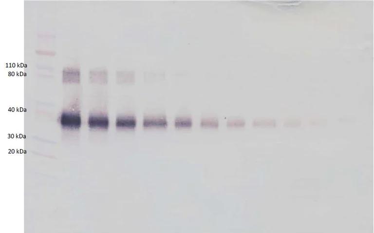 Western blot - Biotin Anti-IL-2 Receptor alpha antibody (AB271230)